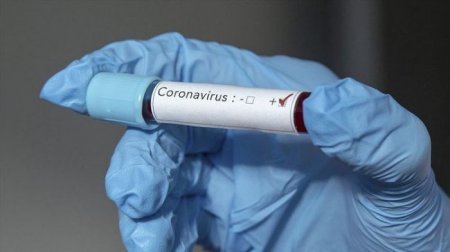 Daha 590 nəfərdə koronavirus aşkarlandı - 7 pasiyent öldü