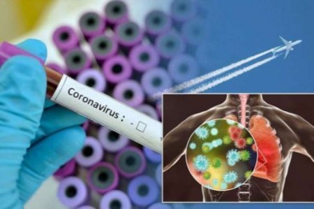 Azərbaycanda son sutkada koronovirusa yoluxanların sayı açıqlandı — RƏSMİ - SON DƏQİQƏ