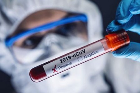 Gürcüstanda koronavirusa 265 yeni yoluxma qeydə alındı