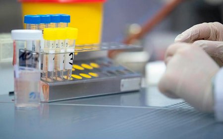 Azərbaycana meymunçiçəyi test dəstləri gətirilib